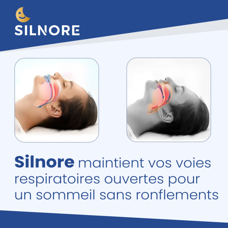 Orthèse Anti-Ronflement – Image 4